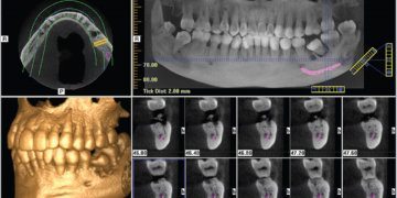 Digital X-Ray